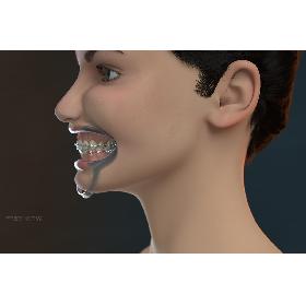 3D model Orthodontic Head (V-Ray)